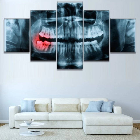 Dentist Teeth Xray Wall Art Canvas Decor Printing