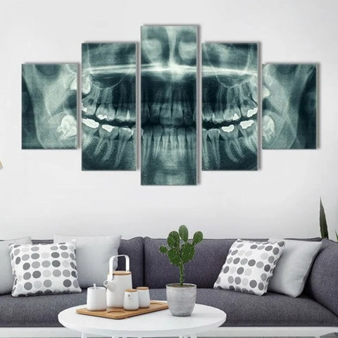 X-ray Dental Face Wall Art Canvas Decor Printing